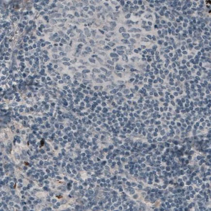 Immunohistochemistry (Formalin/PFA-fixed paraffin-embedded sections) - Anti-LAMA3 antibody [CL3112] (AB242197)