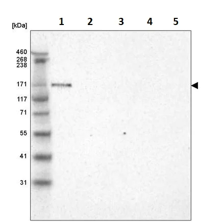 Western blot - Anti-LAMA3 antibody [CL3112] (AB242197)