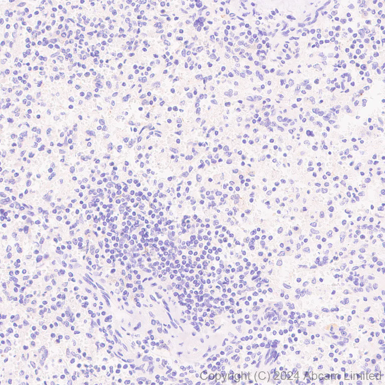 Immunohistochemistry (Formalin/PFA-fixed paraffin-embedded sections) - Anti-LAMA3 antibody [EPR28286-78] (AB321976)