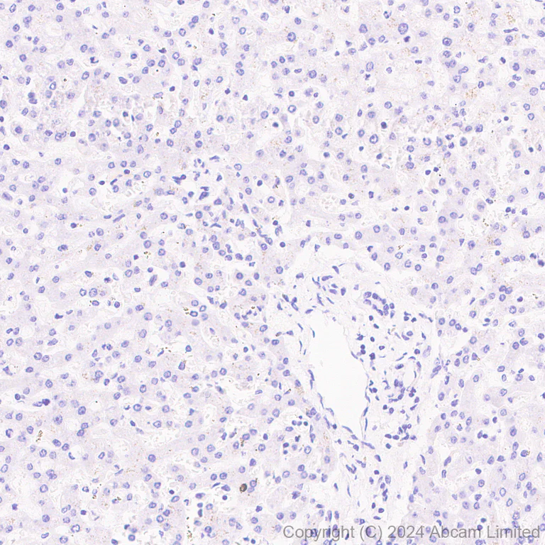 Immunohistochemistry (Formalin/PFA-fixed paraffin-embedded sections) - Anti-LAMA3 antibody [EPR28286-78] (AB321976)