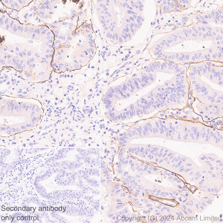 Immunohistochemistry (Formalin/PFA-fixed paraffin-embedded sections) - Anti-LAMA3 antibody [EPR28286-78] (AB321976)