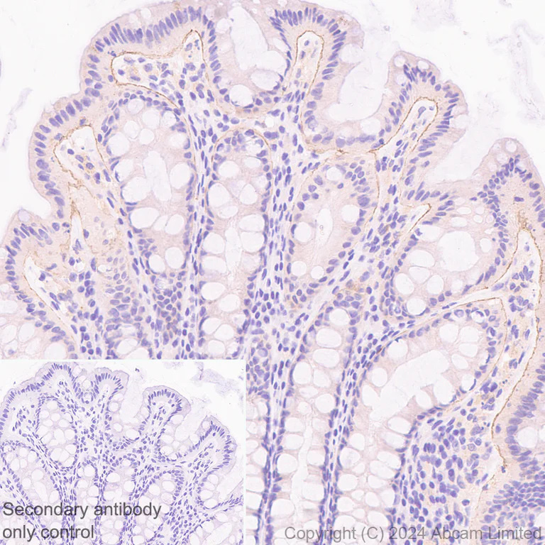 Immunohistochemistry (Formalin/PFA-fixed paraffin-embedded sections) - Anti-LAMA3 antibody [EPR28286-78] (AB321976)