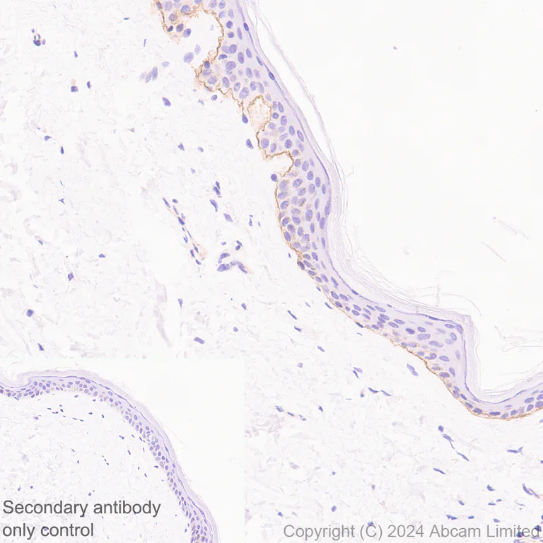 Immunohistochemistry (Formalin/PFA-fixed paraffin-embedded sections) - Anti-LAMA3 antibody [EPR28286-78] (AB321976)