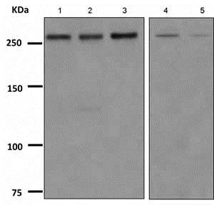 Western blot - Anti-LAMA3 antibody [EPR8266] (AB151715)