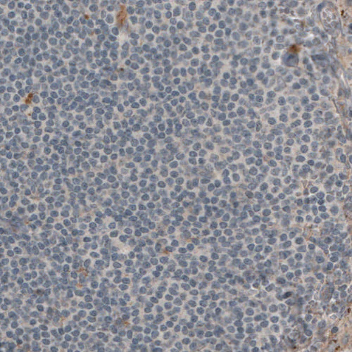 Immunohistochemistry (Formalin/PFA-fixed paraffin-embedded sections) - Anti-LAMB1 Antibody [CL2970] (AB327111)