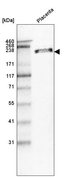 Western blot - Anti-LAMB1 Antibody [CL2970] (AB327111)