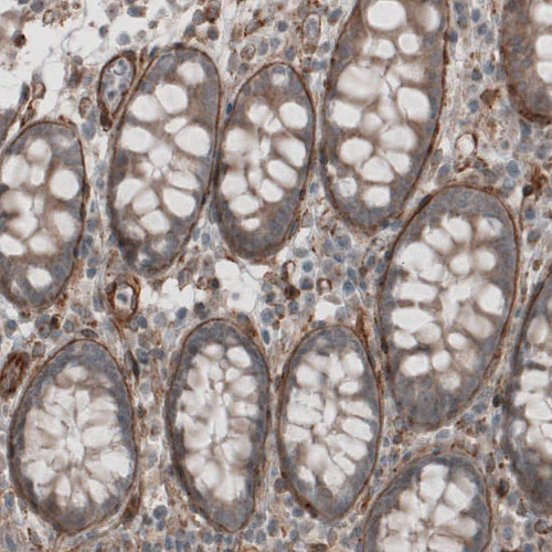 Immunohistochemistry (Formalin/PFA-fixed paraffin-embedded sections) - Anti-LAMB2 Antibody [CL2976] (AB327112)