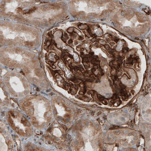 Immunohistochemistry (Formalin/PFA-fixed paraffin-embedded sections) - Anti-LAMB2 Antibody [CL2976] (AB327112)