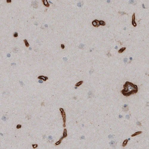Immunohistochemistry (Formalin/PFA-fixed paraffin-embedded sections) - Anti-LAMB2 Antibody [CL2976] (AB327112)