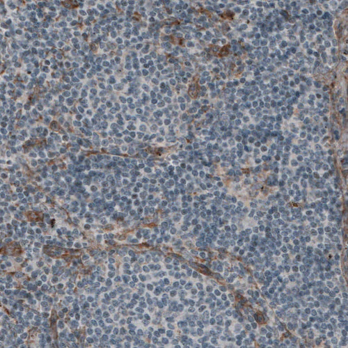 Immunohistochemistry (Formalin/PFA-fixed paraffin-embedded sections) - Anti-LAMB2 Antibody [CL2976] (AB327112)