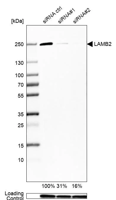 Western blot - Anti-LAMB2 Antibody [CL2976] (AB327112)