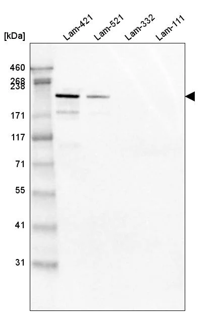 Western blot - Anti-LAMB2 Antibody [CL2976] (AB327112)