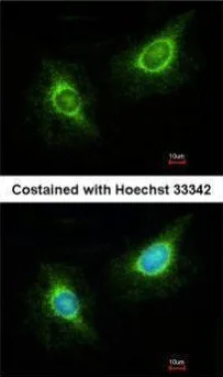 Immunocytochemistry/ Immunofluorescence - Anti-LAMB3 antibody (AB97765)