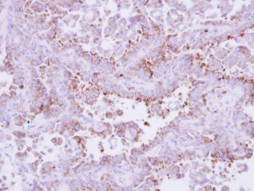 Immunohistochemistry (Formalin/PFA-fixed paraffin-embedded sections) - Anti-LAMB3 antibody (AB97765)