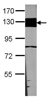 Western blot - Anti-LAMB3 antibody (AB97765)