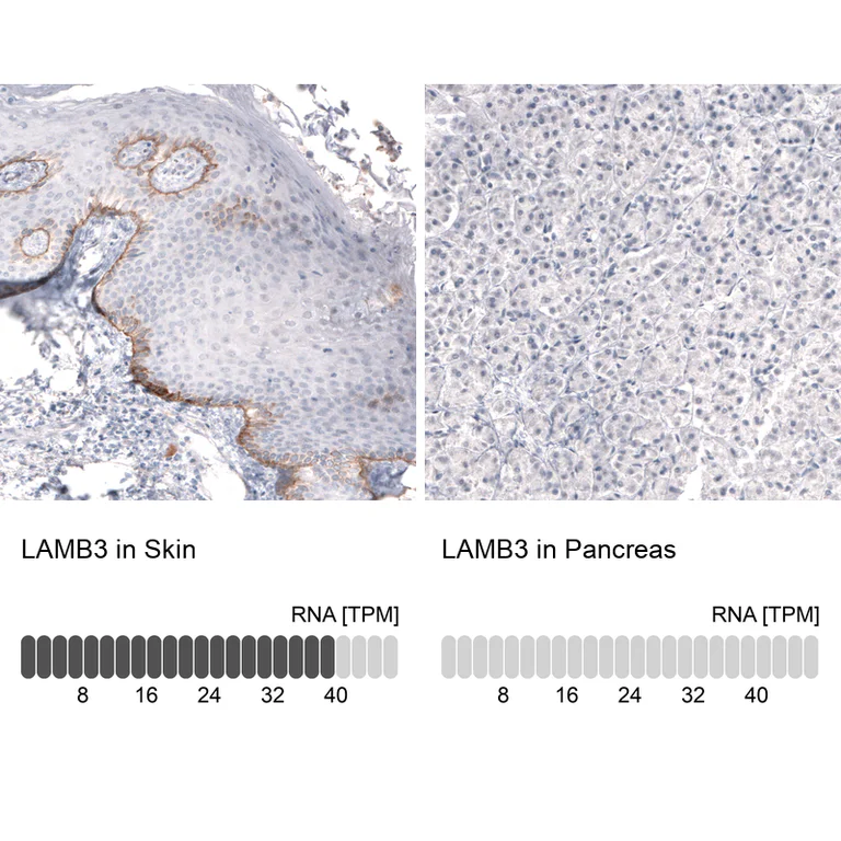 Immunohistochemistry (Formalin/PFA-fixed paraffin-embedded sections) - Anti-LAMB3 Antibody [CL3353 ] (AB327113)