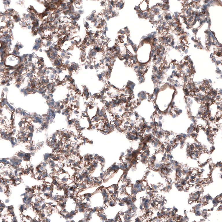 Immunohistochemistry (Formalin/PFA-fixed paraffin-embedded sections) - Anti-LAMB3 Antibody [CL3353 ] (AB327113)
