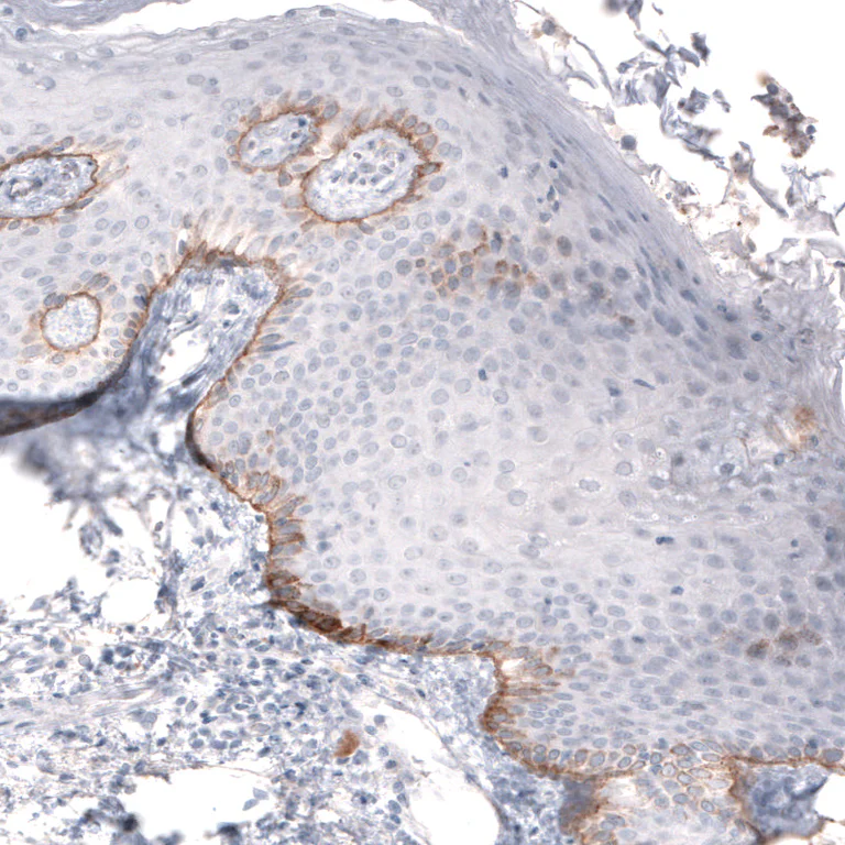 Immunohistochemistry (Formalin/PFA-fixed paraffin-embedded sections) - Anti-LAMB3 Antibody [CL3353 ] (AB327113)