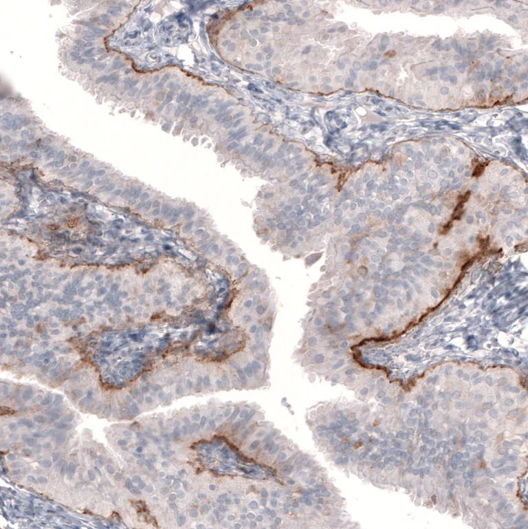 Immunohistochemistry (Formalin/PFA-fixed paraffin-embedded sections) - Anti-LAMB3 Antibody [CL3353 ] (AB327113)