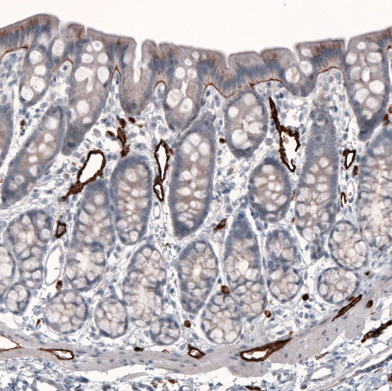 Immunohistochemistry (Formalin/PFA-fixed paraffin-embedded sections) - Anti-LAMB3 Antibody [CL3353 ] (AB327113)