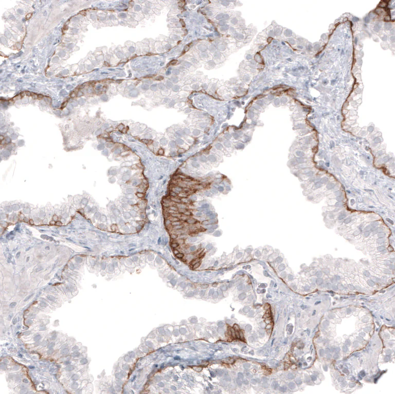 Immunohistochemistry (Formalin/PFA-fixed paraffin-embedded sections) - Anti-LAMB3 Antibody [CL3353 ] (AB327113)