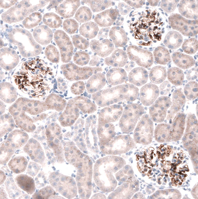 Immunohistochemistry (Formalin/PFA-fixed paraffin-embedded sections) - Anti-LAMB3 Antibody [CL3353 ] (AB327113)