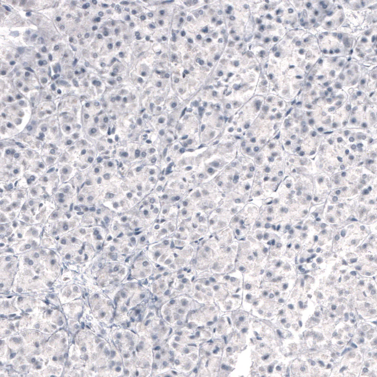 Immunohistochemistry (Formalin/PFA-fixed paraffin-embedded sections) - Anti-LAMB3 Antibody [CL3353 ] (AB327113)