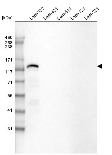 Western blot - Anti-LAMB3 Antibody [CL3353 ] (AB327113)