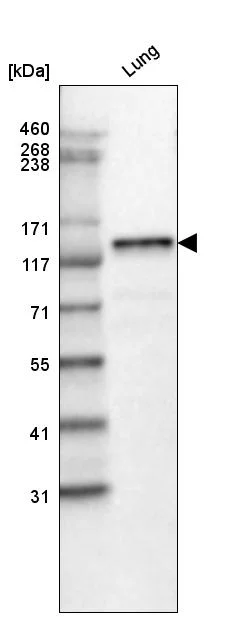 Western blot - Anti-LAMB3 Antibody [CL3353 ] (AB327113)