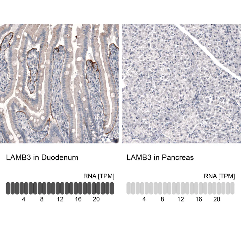 Immunohistochemistry (Formalin/PFA-fixed paraffin-embedded sections) - Anti-LAMB3 Antibody [CL3363] (AB327114)