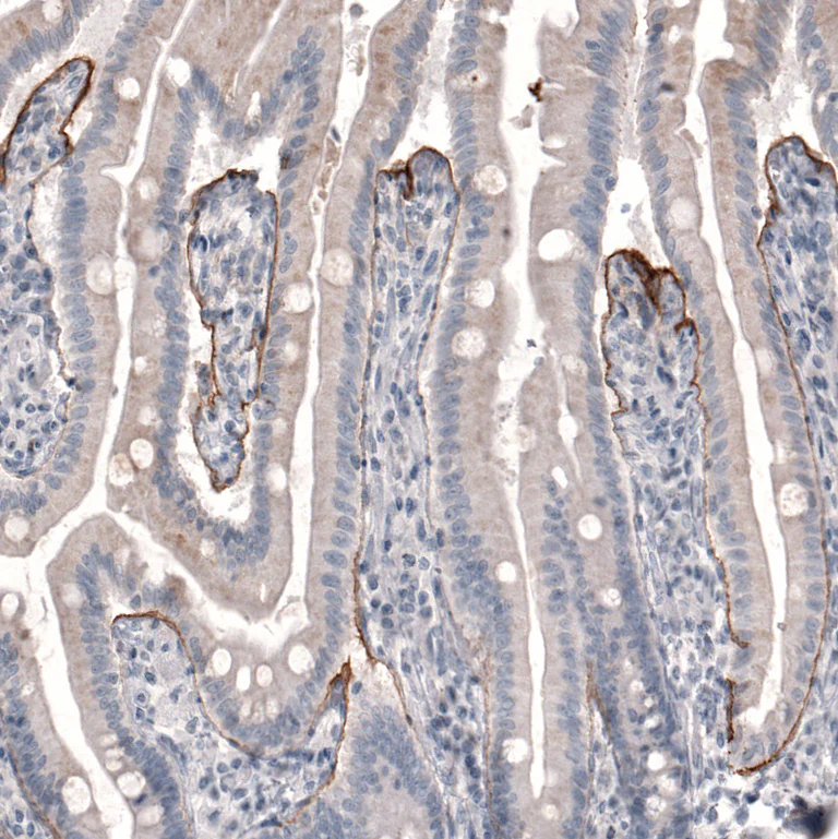 Immunohistochemistry (Formalin/PFA-fixed paraffin-embedded sections) - Anti-LAMB3 Antibody [CL3363] (AB327114)