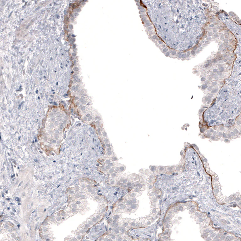 Immunohistochemistry (Formalin/PFA-fixed paraffin-embedded sections) - Anti-LAMB3 Antibody [CL3363] (AB327114)