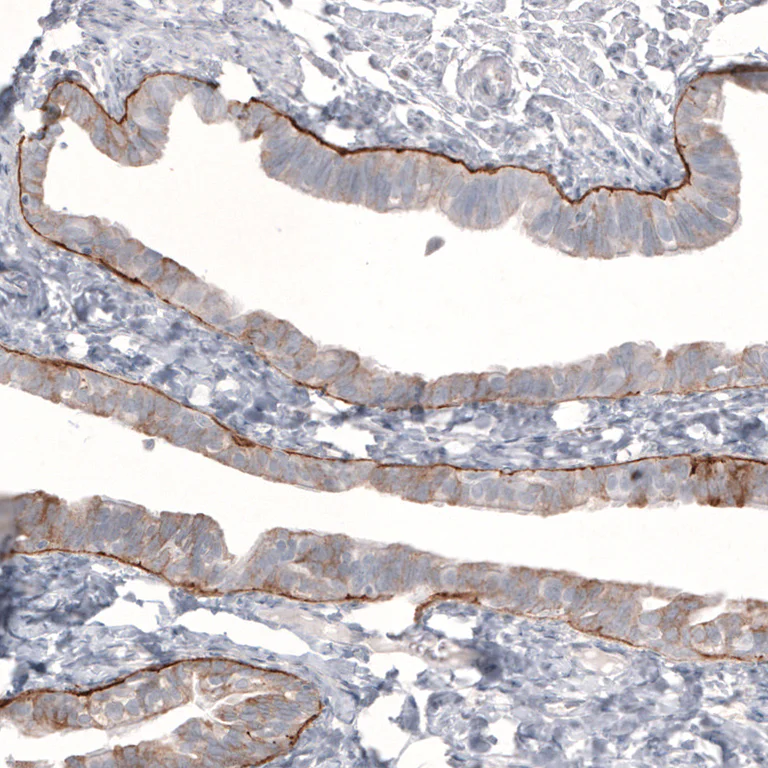 Immunohistochemistry (Formalin/PFA-fixed paraffin-embedded sections) - Anti-LAMB3 Antibody [CL3363] (AB327114)