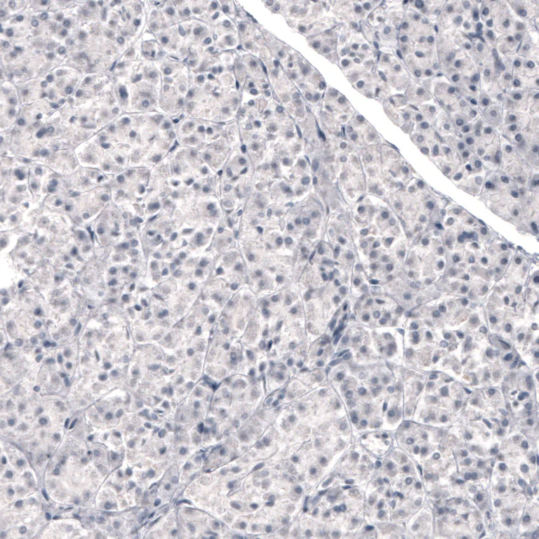 Immunohistochemistry (Formalin/PFA-fixed paraffin-embedded sections) - Anti-LAMB3 Antibody [CL3363] (AB327114)
