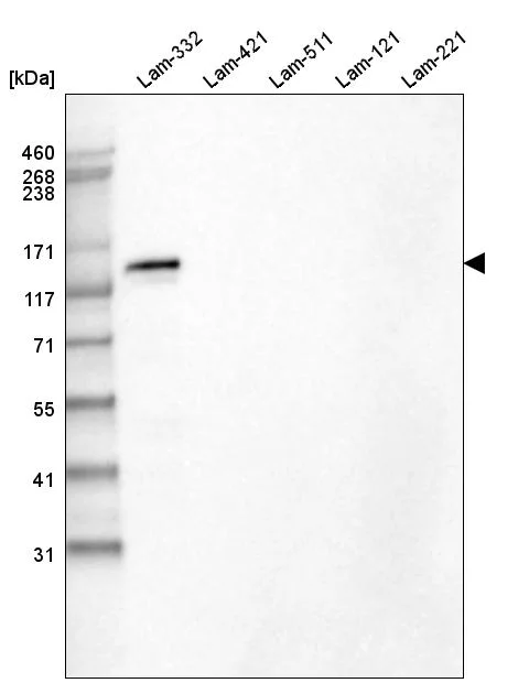 Western blot - Anti-LAMB3 Antibody [CL3363] (AB327114)