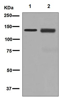 Western blot - Anti-LAMB3 antibody [EPR7524] (AB128864)