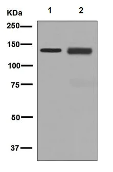 Western blot - Anti-LAMB3 antibody [EPR7524] - BSA and Azide free (AB248193)