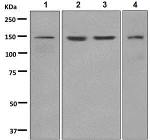 Western blot - Anti-LAMB3 antibody [EPR7525] - BSA and Azide free (AB248956), expandable thumbnail