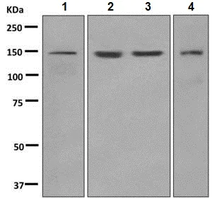 Western blot - Anti-LAMB3 antibody [EPR7525] - BSA and Azide free (AB248956)