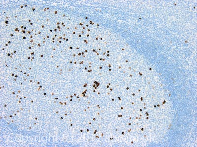 Immunohistochemistry (Formalin/PFA-fixed paraffin-embedded sections) - Anti-Lambda Free Light Chain antibody [3D12] (AB1944), expandable thumbnail