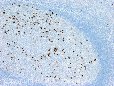 Immunohistochemistry (Formalin/PFA-fixed paraffin-embedded sections) - Anti-Lambda Free Light Chain antibody [3D12] (AB1944)