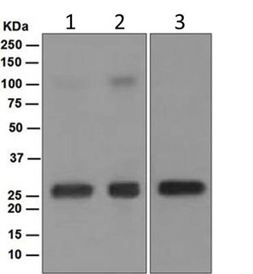 Western blot - Anti-Lambda Light chain antibody [EPR5367-62] (ab124719), expandable thumbnail