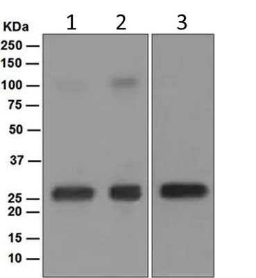 Western blot - Anti-Lambda Light chain antibody [EPR5367-62] (AB124719)