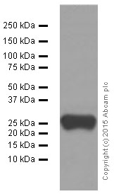Western blot - Anti-Lambda Light chain antibody [EPR5367-62] (AB124719), expandable thumbnail