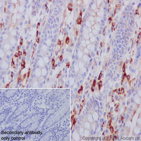 Immunohistochemistry (Formalin/PFA-fixed paraffin-embedded sections) - Anti-Lambda Light chain antibody [EPR5367-62] - BSA and Azide free (AB185131), expandable thumbnail