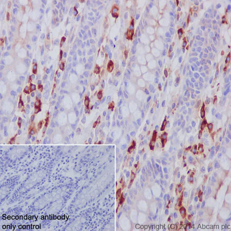 Immunohistochemistry (Formalin/PFA-fixed paraffin-embedded sections) - Anti-Lambda Light chain antibody [EPR5367-62] - BSA and Azide free (AB185131)