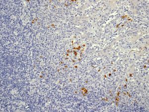 Immunohistochemistry (Formalin/PFA-fixed paraffin-embedded sections) - Anti-Lambda Light chain antibody [EPR5367-62] - BSA and Azide free (AB185131), expandable thumbnail