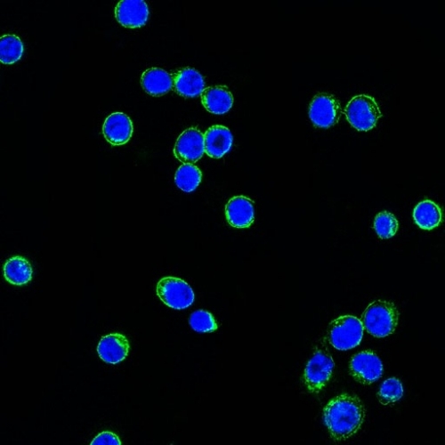 Immunocytochemistry - Anti-Lambda Light chain antibody [LcN-2] (AB187370), expandable thumbnail