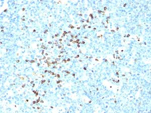 Immunohistochemistry (Formalin/PFA-fixed paraffin-embedded sections) - Anti-Lambda Light chain antibody [LcN-2] (AB187370)