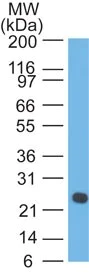 Western blot - Anti-Lambda Light chain antibody [LcN-2] (AB187370)